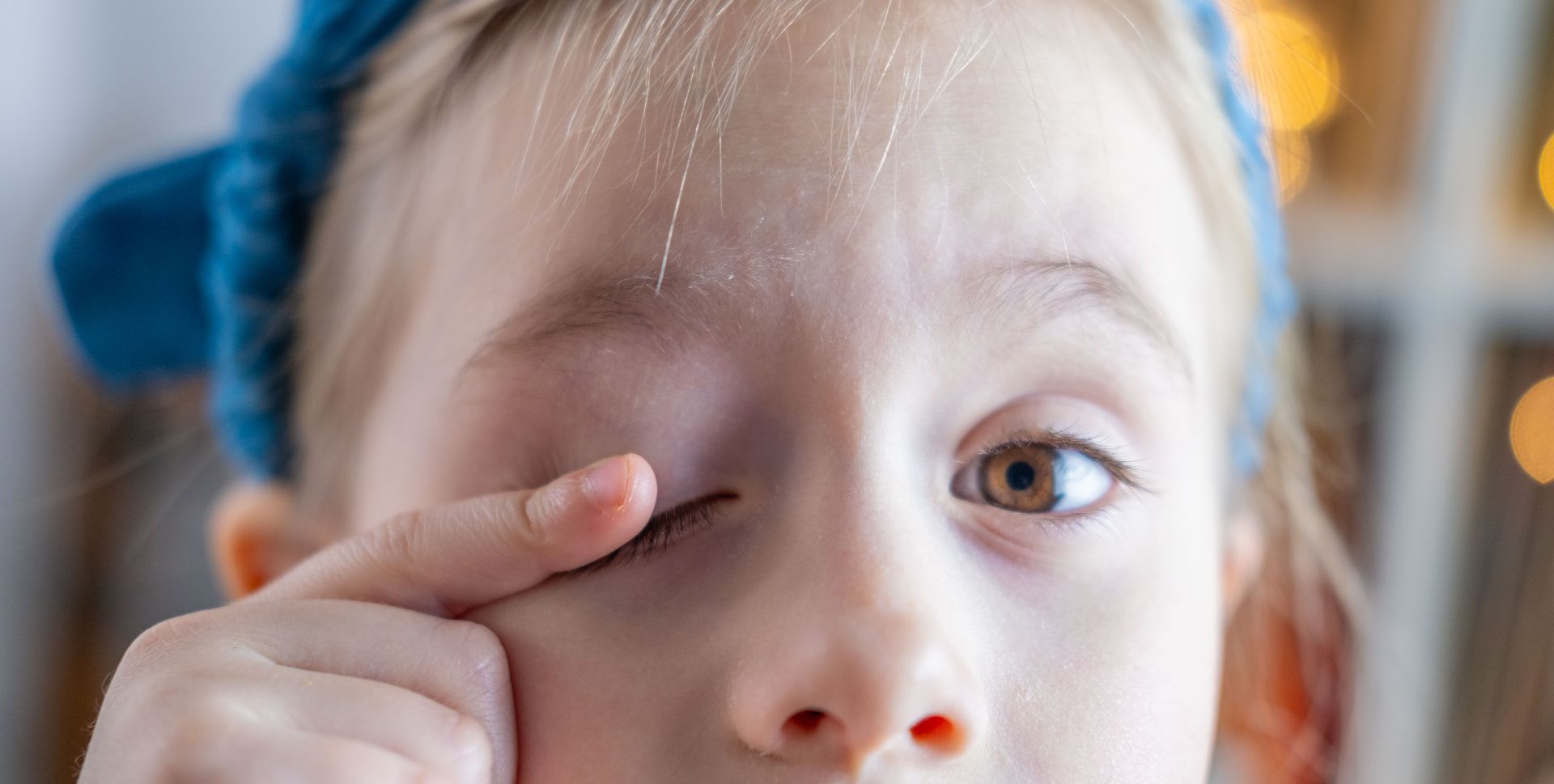 нервный тик у ребенка